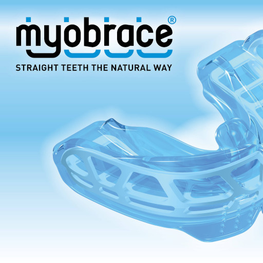 Myobrace апарати